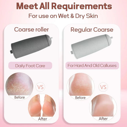 ODEIUN™ Rechargeable Electric Foot Callus Remover