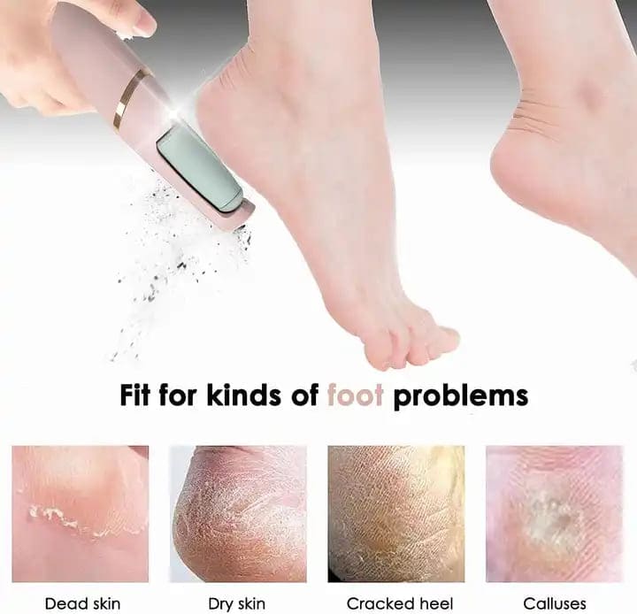 ODEIUN™ Rechargeable Electric Foot Callus Remover
