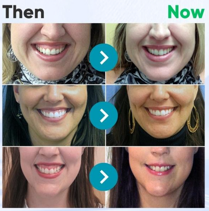 ODEIUN™ Bee Venom Toothpaste | Regrow Gums, Stop Sensitivity & Remove Tartar Naturally.