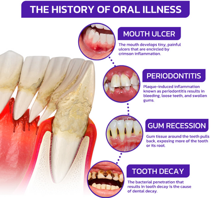 ODEIUN™ Bee Venom Toothpaste | Regrow Gums, Stop Sensitivity & Remove Tartar Naturally.